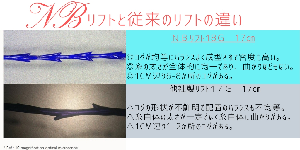 NBリフトと従来の糸リフトの違い