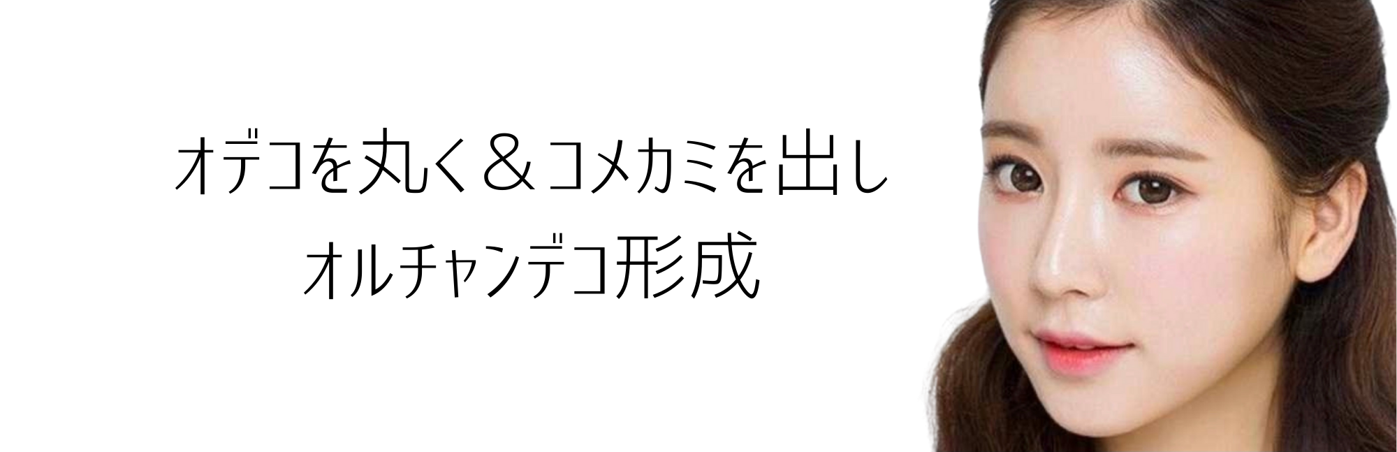 公式 額をまるく整形 オルチャンデコ Nビューティークリニック銀座